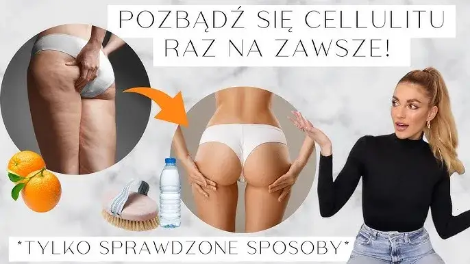 Zdjęcie Jak się pozbyć cellulitu online - sprawdzone metody i porady