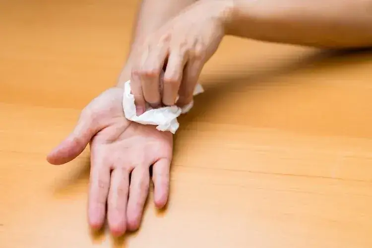 Zdjęcie Skuteczne metody na pocenie się dłoni - jak zapobiec nadmiernemu poceniu