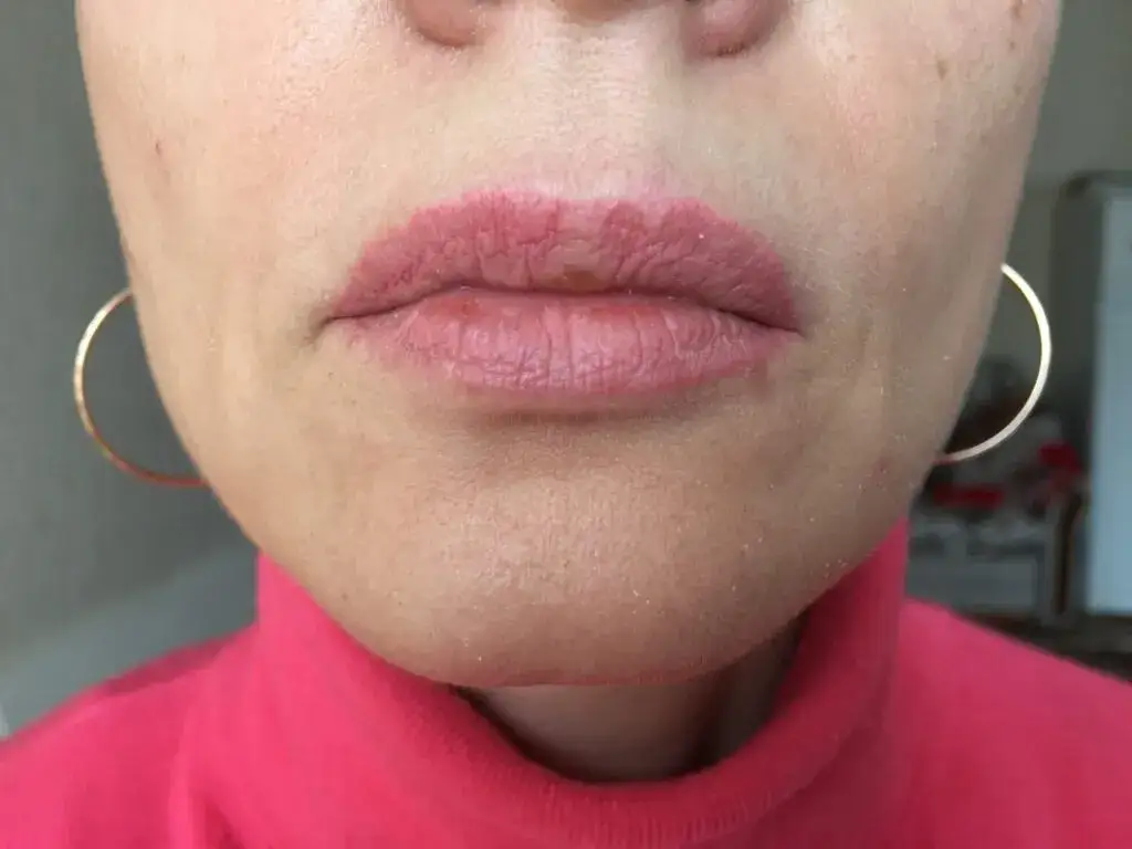 Zdjęcie Objawy uczulenia na makijaż permanentny – jak je rozpoznać i unikać