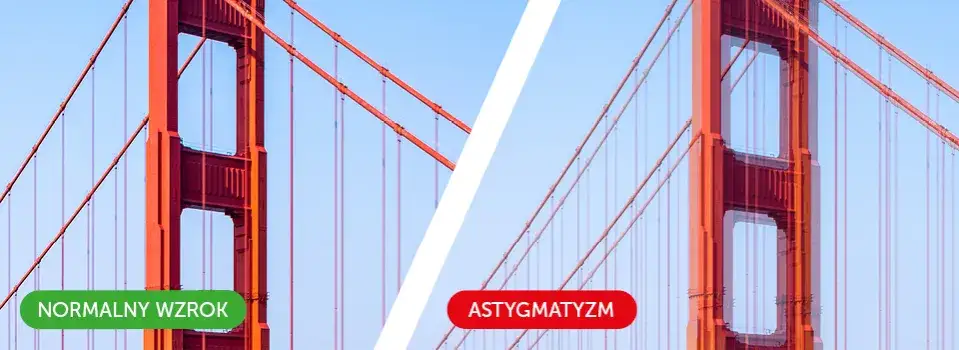 Zdjęcie Jak widzi astygmatyk litery? Zrozumienie zniekształceń w widzeniu