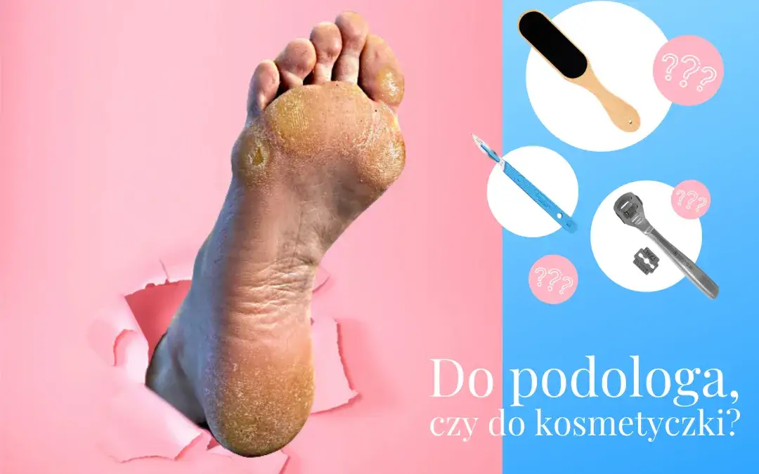 Zdjęcie Czym zajmuje się lekarz podolog i jak może uratować Twoje stopy