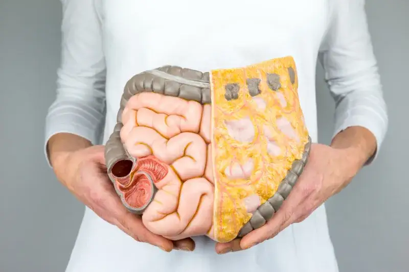 Zdjęcie Mikrobiom jelitowy: Klucz do zdrowia układu pokarmowego człowieka?