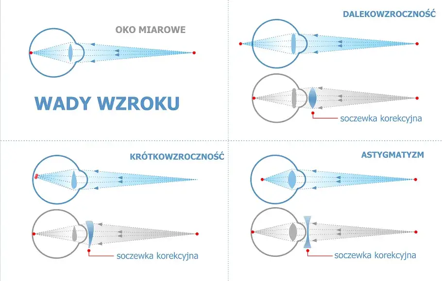 Zdjęcie Objawy wad wzroku u niemowląt – jak rozpoznać problemy ze wzrokiem u dziecka
