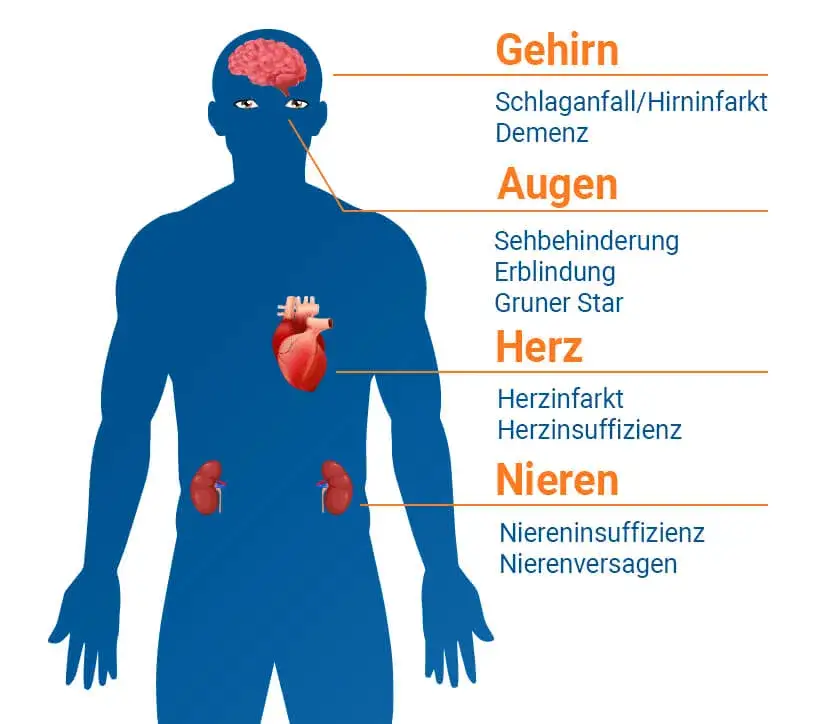 Zdjęcie Symptome Bluthochdruck: Woran Sie gefährliche Anzeichen erkennen