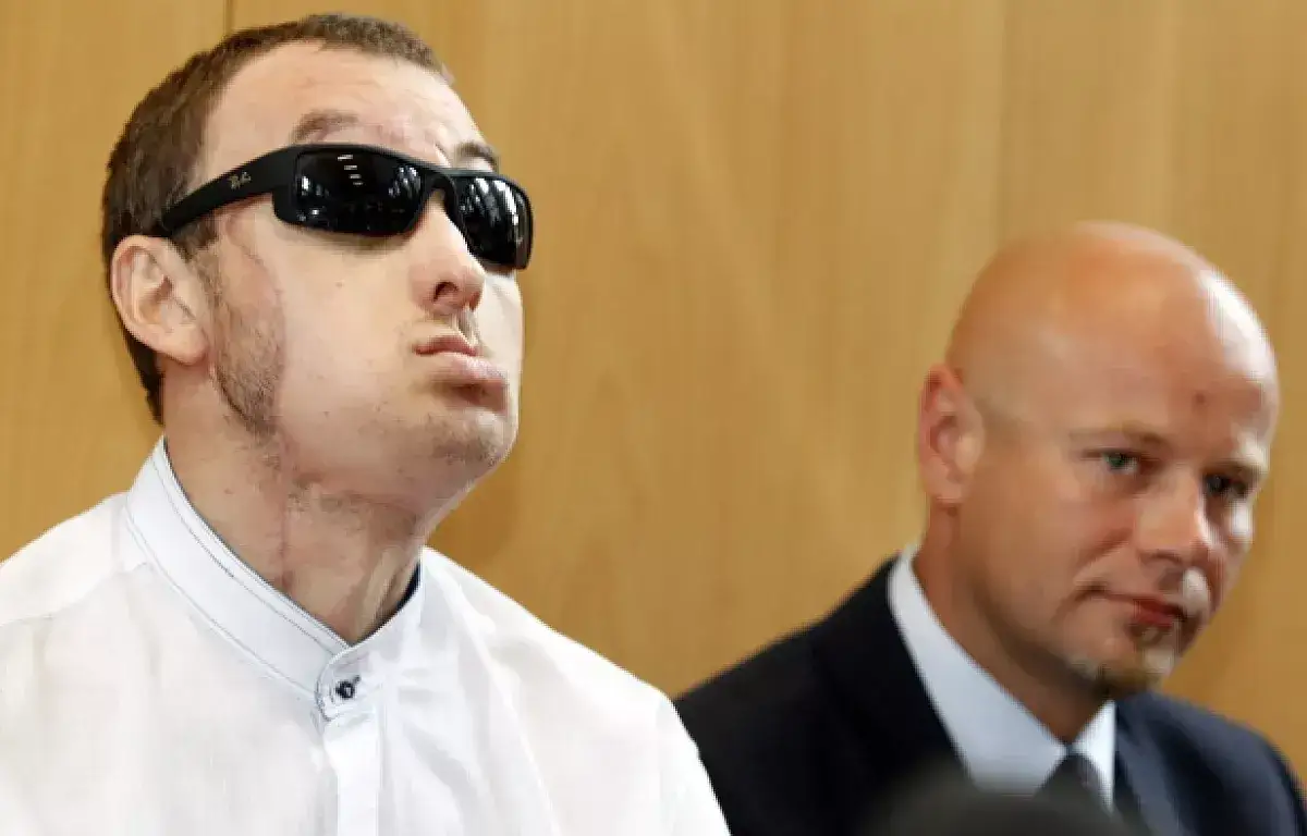 Zdjęcie Pierwszy przeszczep twarzy w Polsce: historia, wyzwania i emocje pacjenta