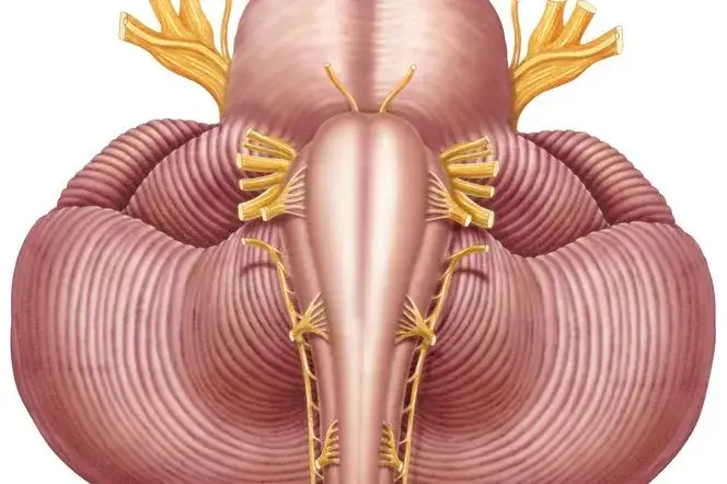 Zdjęcie Uszkodzenie nerwów czaszkowych objawy – co warto wiedzieć, by nie przegapić?