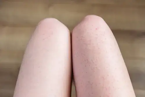 Zdjęcie Jak pielęgnować skórę po depilacji depilatorem, aby uniknąć podrażnień