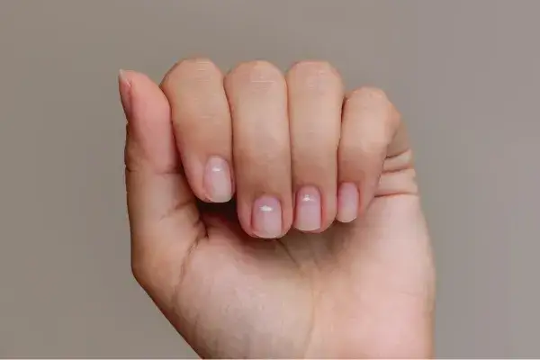 Zdjęcie Co oznaczają białe plamy na paznokciach i jak je leczyć?