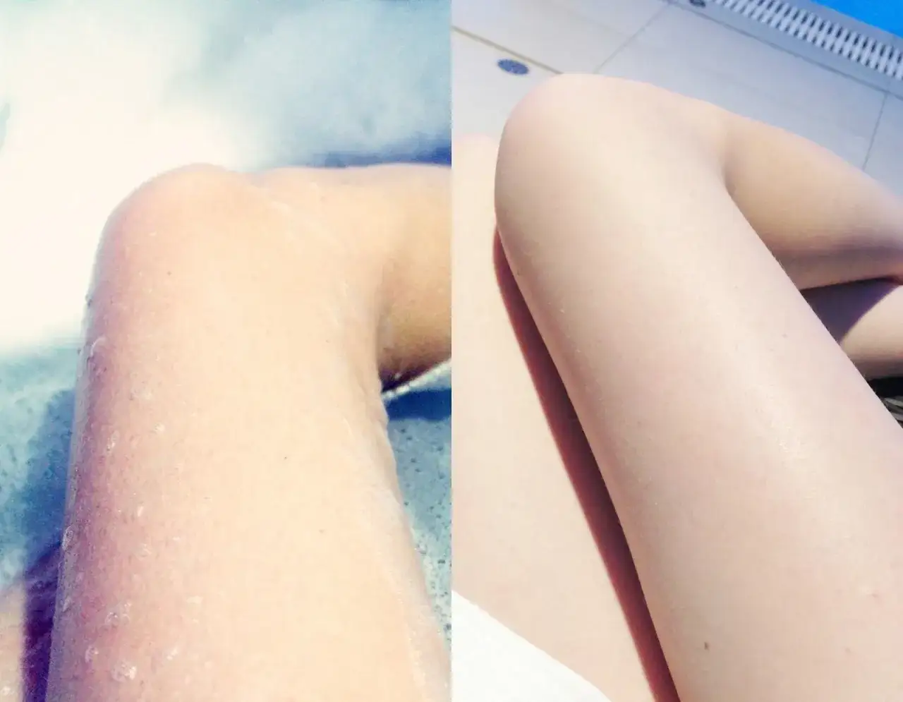 Zdjęcie Jak uniknąć krostek po goleniu i cieszyć się gładką skórą