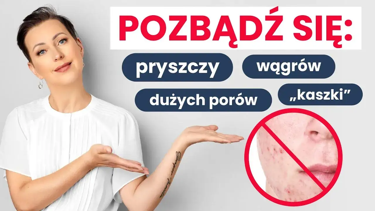 Zdjęcie Skuteczne sposoby na pryszcze podskórne - uniknij bólu i podrażnień