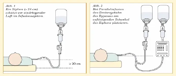 Zdjęcie Kroplówka do wenflonu: Instrukcja podłączenia krok po kroku