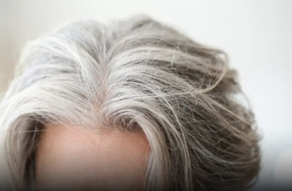 Zdjęcie Czy po operacji można farbować włosy? Bezpieczeństwo i zalecenia dla pacjentów