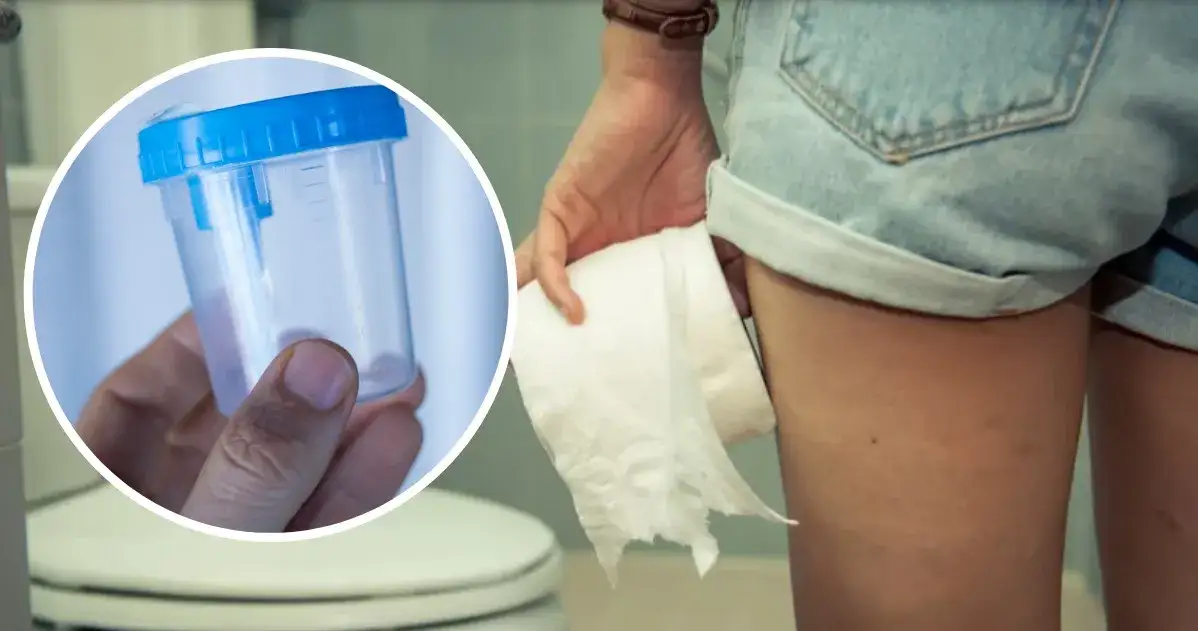 Zdjęcie Jak przygotować kał do badania - uniknij błędów i zyskaj wiarygodne wyniki