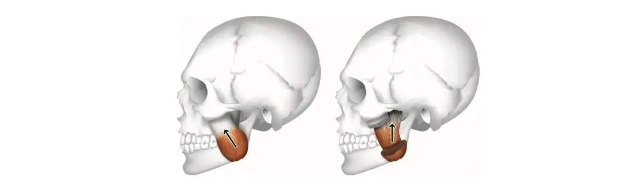 Zdjęcie Dolor de masetero: Alivia la tensi&oacute;n mandibular y el bruxismo