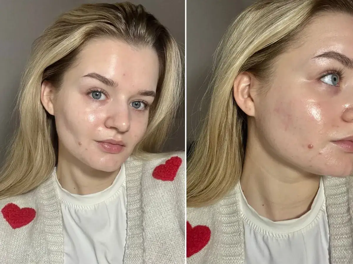 Zdjęcie Jak prawidłowo nakładać serum na twarz? Maksymalizuj efekty!