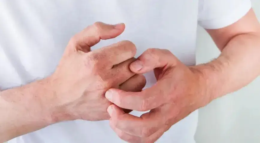 Zdjęcie Jakie kosmetyki w czasie chemioterapii pomogą chronić wrażliwą skórę?