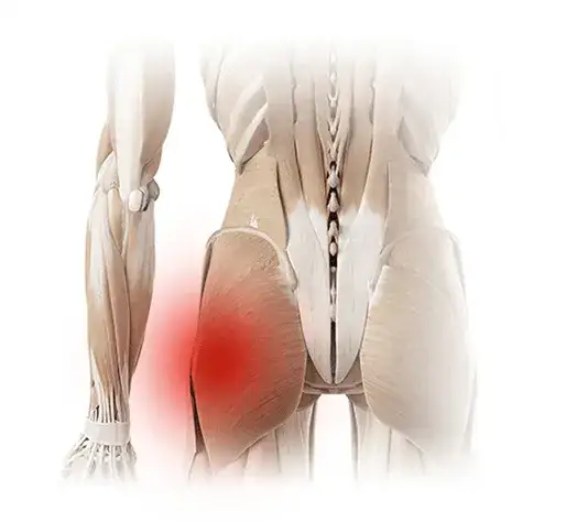 Zdjęcie Ból biodra objawy: Jak rozpoznać niepokojące symptomy bólu