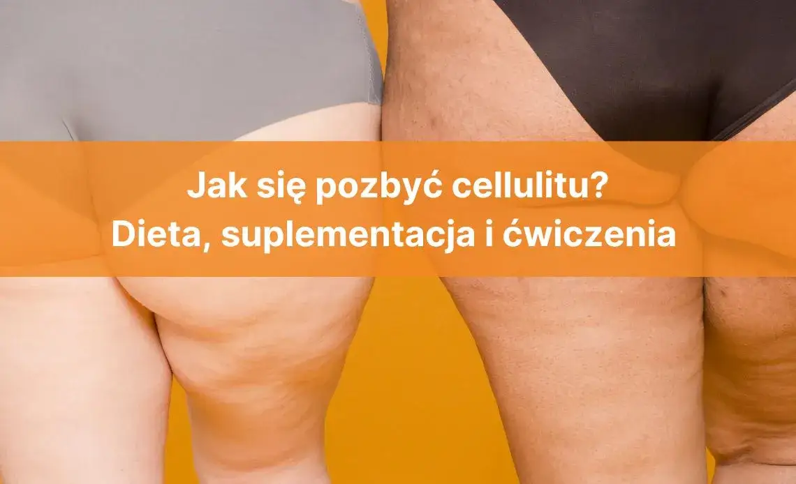 Zdjęcie Cytaty z filmu Jak się pozbyć cellulitu, które rozśmieszą i zaskoczą