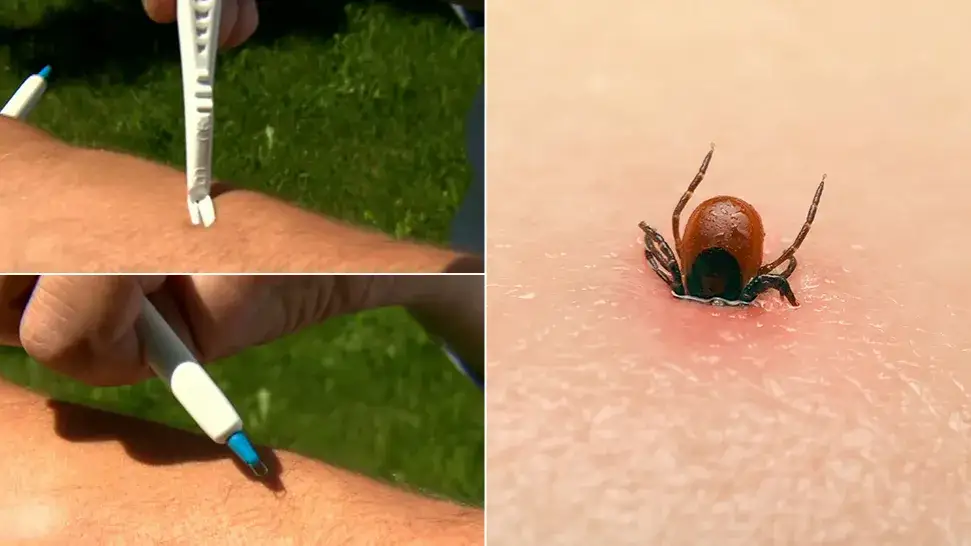 Zdjęcie Czy kleszcz lata? Odkryj prawdę o kleszczach i ich zachowaniu