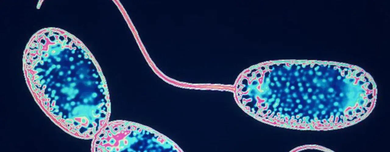 Zdjęcie Kiedy wlać bakterie do akwarium, aby uniknąć problemów z wodą?