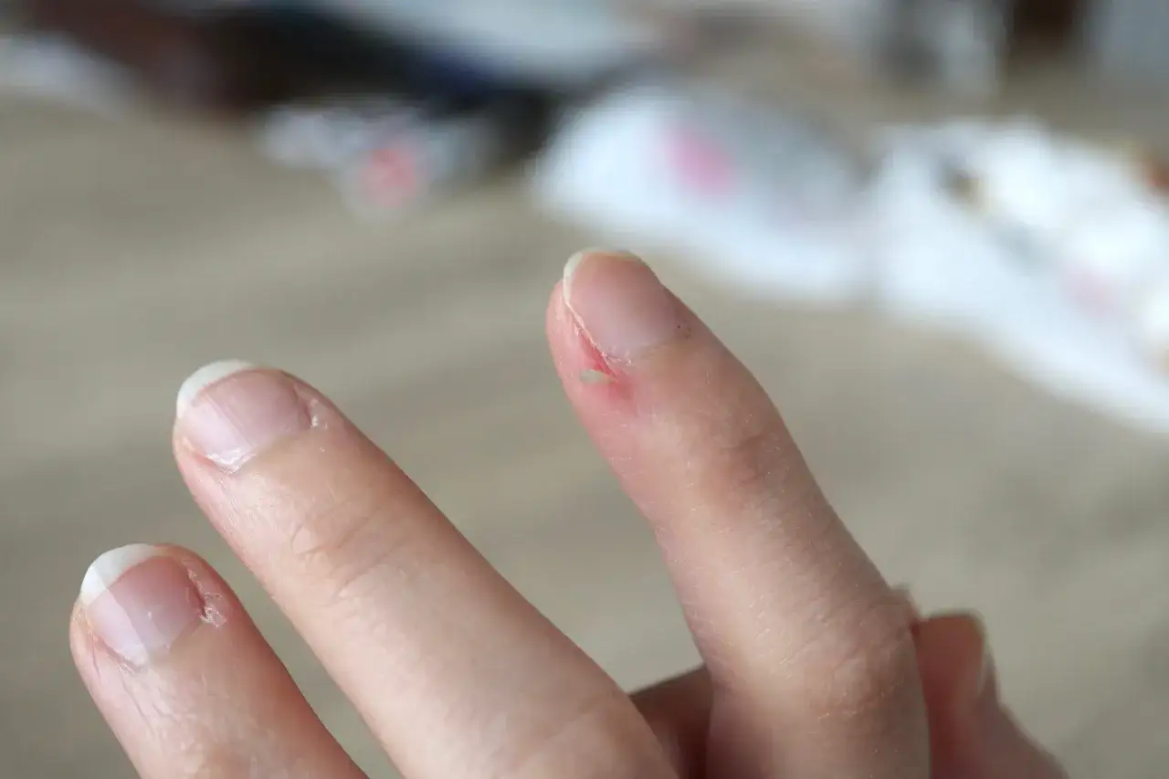 Zdjęcie Jak dbać o skórki przy paznokciach, aby uniknąć pęknięć i infekcji