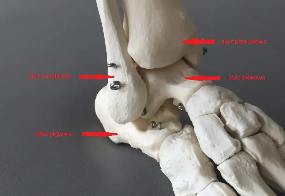 Zdjęcie Skręcony staw skokowy: ile przerwy potrzebujesz na powrót do zdrowia?