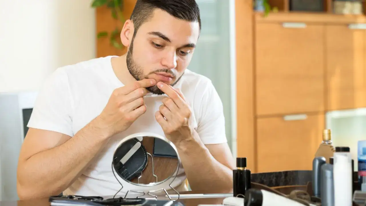 Zdjęcie Jak szybko pozbyć się pryszcza - sprawdzone metody na natychmiastowy efekt