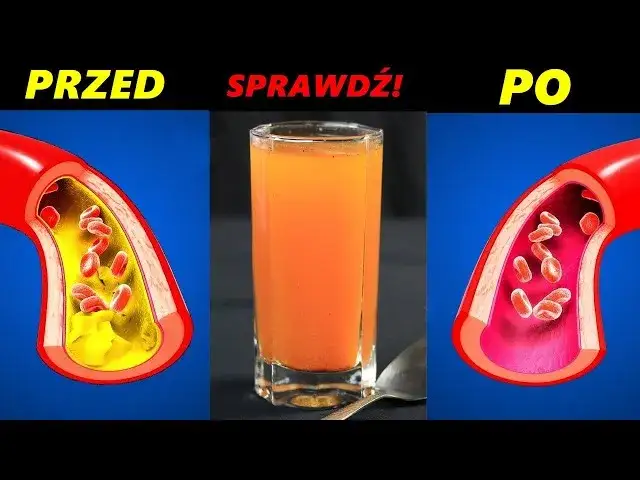 Zdjęcie Napój na zatkane tętnice, który poprawi Twoje zdrowie serca