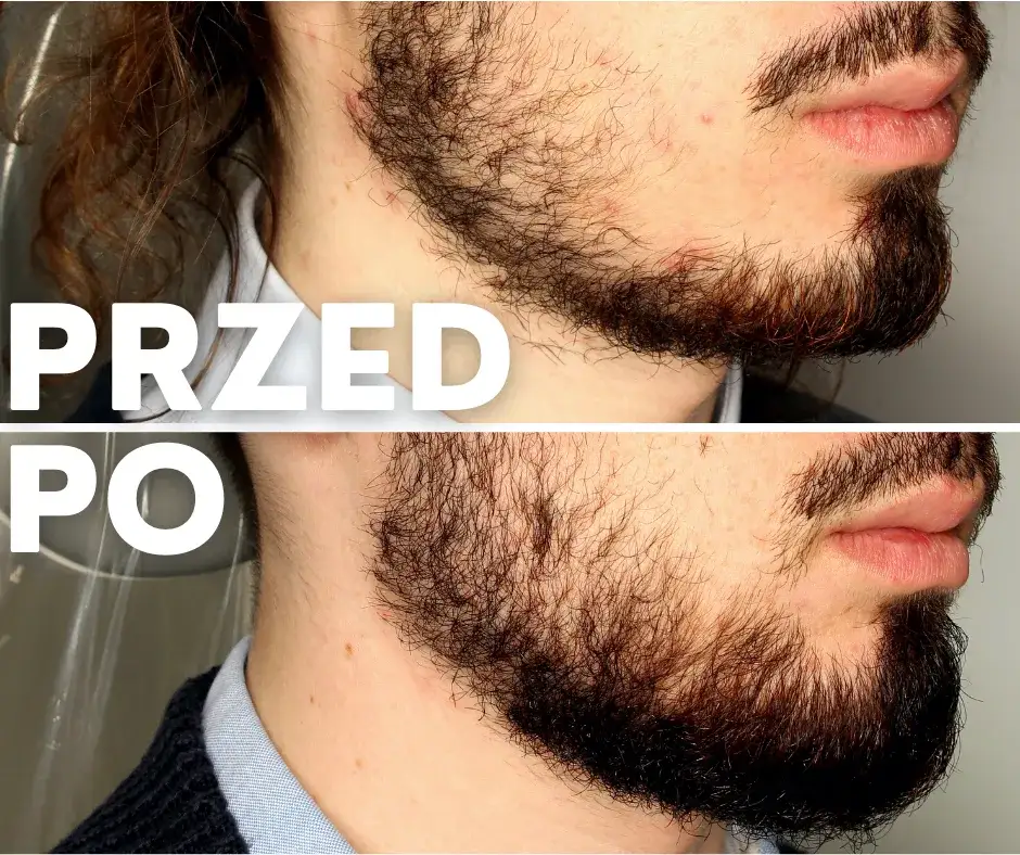 Zdjęcie Kiedy zarost gęstnieje? Wiek, geny i fakty o Twojej brodzie