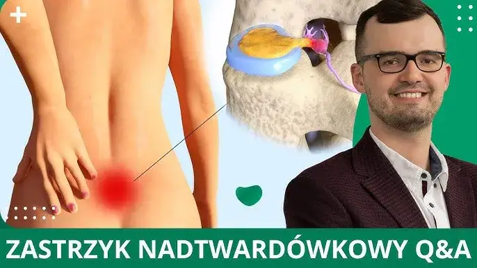 Zdjęcie Jakie zastrzyki na ból kręgosłupa skutecznie łagodzą ból?