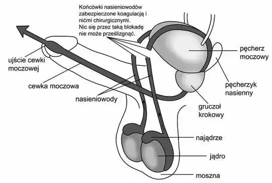 Zdjęcie Czy wazektomia to grzech? Odkryj moralne dylematy w Kościele katolickim