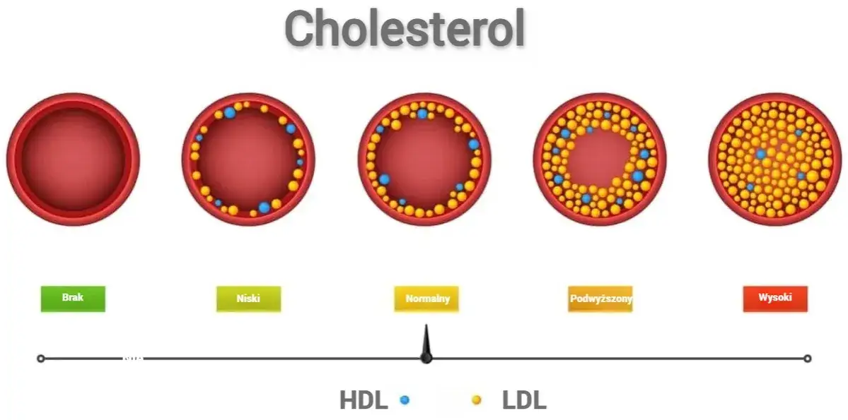 Zdjęcie Cholesterol 206 mg/dl – czy to dużo? Sprawdź, co to oznacza dla zdrowia