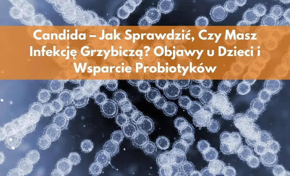 Zdjęcie Jak leczyć candidę probiotykami? 5 skutecznych metod