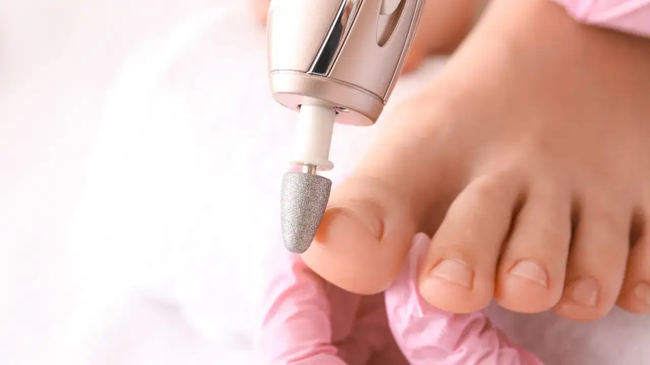 Zdjęcie Jak skutecznie leczyć paznokcie rurkowate u nóg i uniknąć bólu