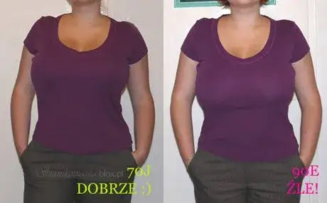 Zdjęcie Zmniejszenie biustu NFZ gdzie uzyskać refundację i pomoc medyczną
