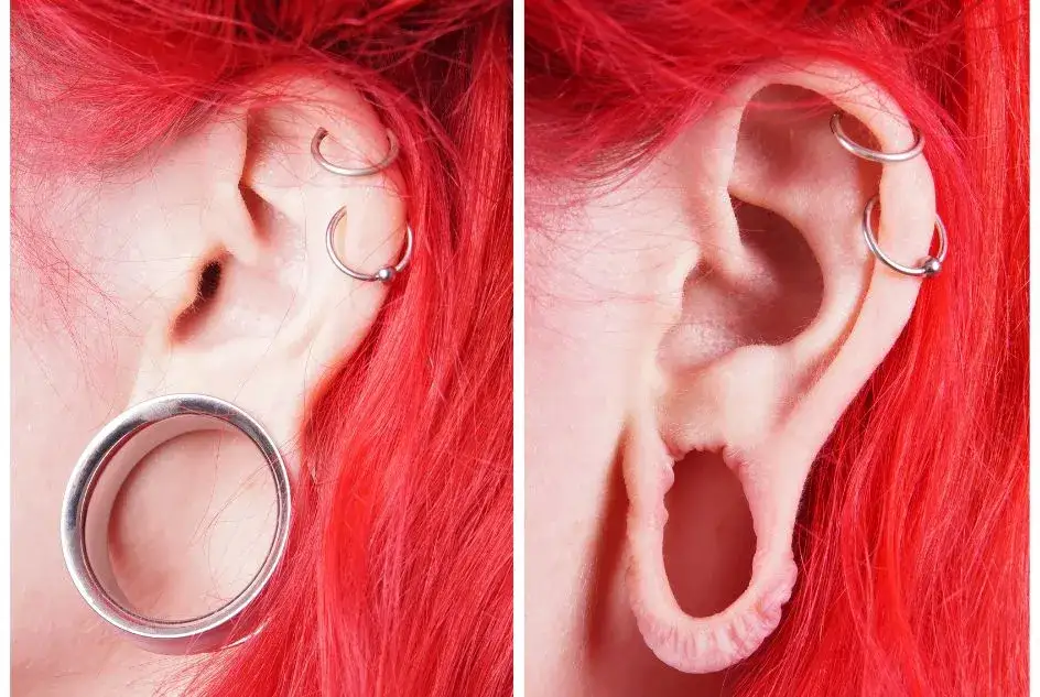 Zdjęcie Jak przemywać kolczyk w uchu, aby uniknąć infekcji i bólu