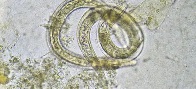 Zdjęcie Objawy odrobaczania: co powinieneś wiedzieć o skutkach leczenia