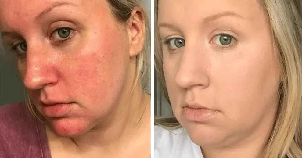 Zdjęcie Jak podkład wygładzający może odmienić Twoją cerę i ukryć niedoskonałości