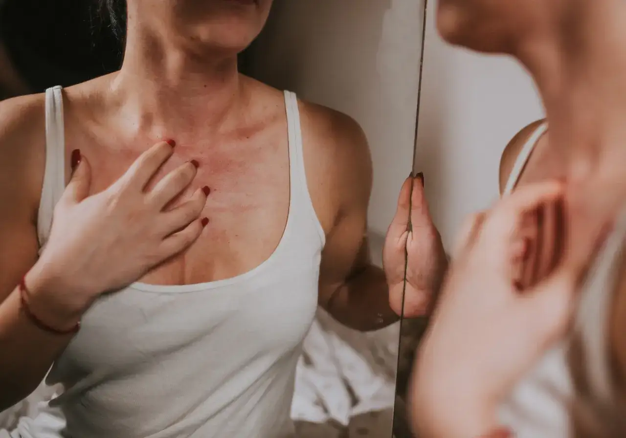 Zdjęcie Jak wygląda uczulenie na perfumy? Objawy, które musisz znać