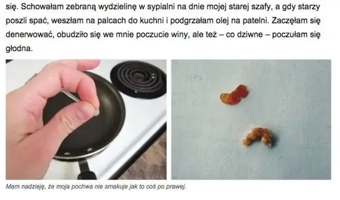 Zdjęcie Nadmierny śluz z pochwy przyczyny – kiedy to może być niebezpieczne?