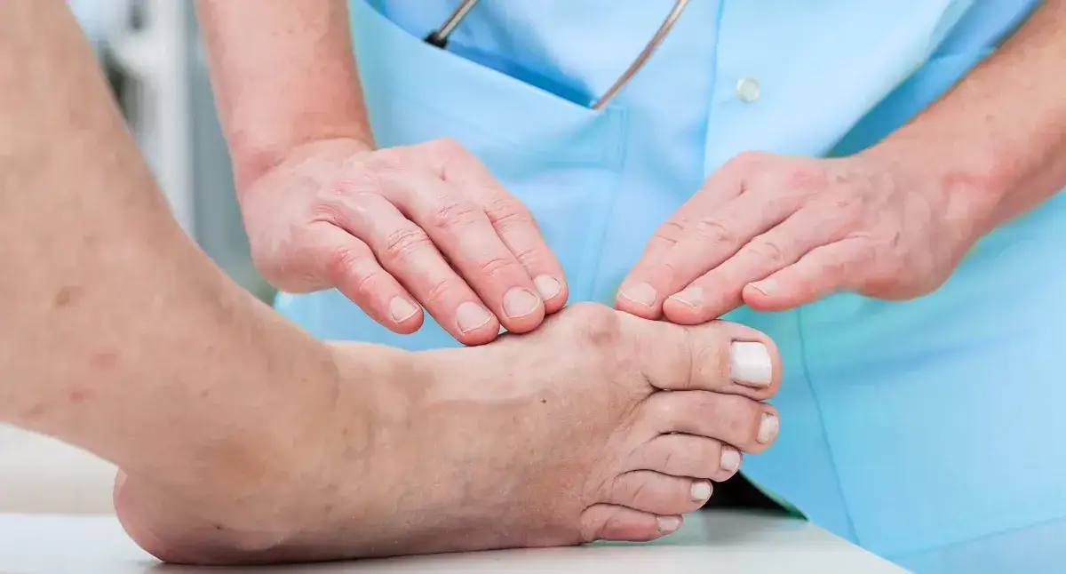 Zdjęcie Ile trwa rehabilitacja po operacji haluksa? Poznaj czas powrotu do zdrowia