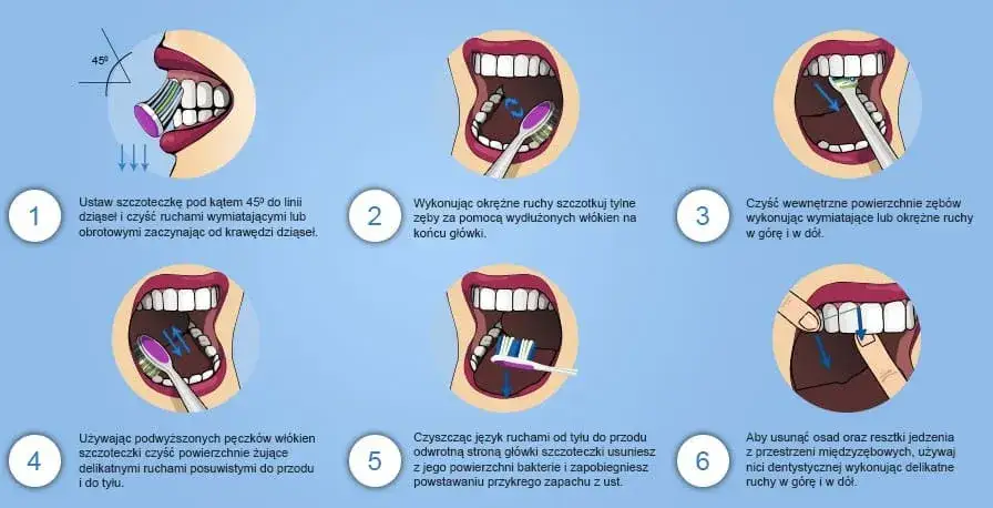 Zdjęcie Jak zapobiec próchnicy? Skuteczne metody na zdrowe zęby każdego dnia