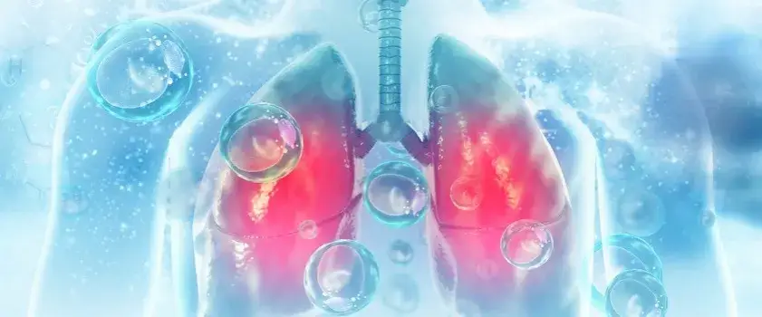 Zdjęcie Jak długo trwa zapalenie płuc u osób starszych? Kluczowe informacje