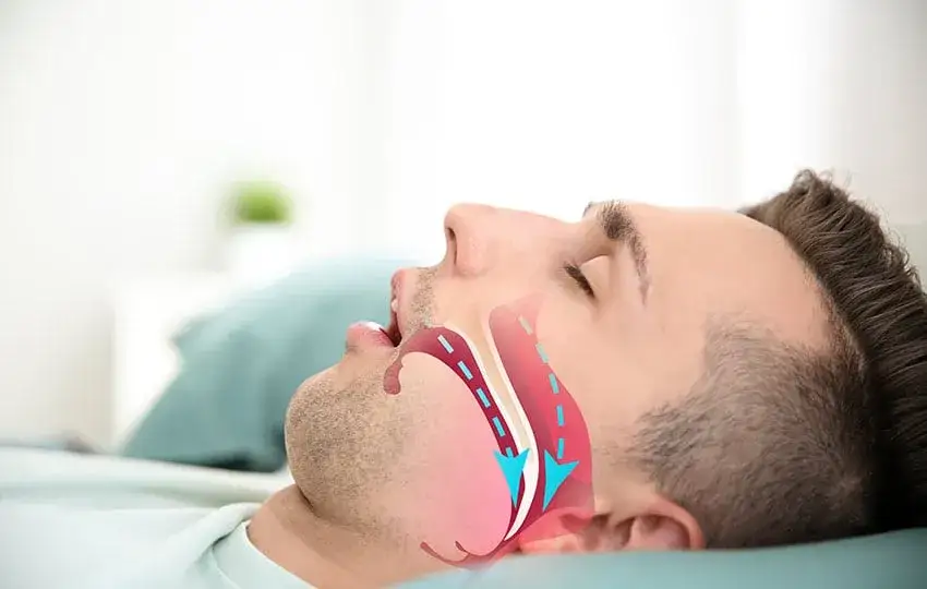 Zdjęcie Skuteczne leki na chrapanie – poznaj sposoby na cichy sen