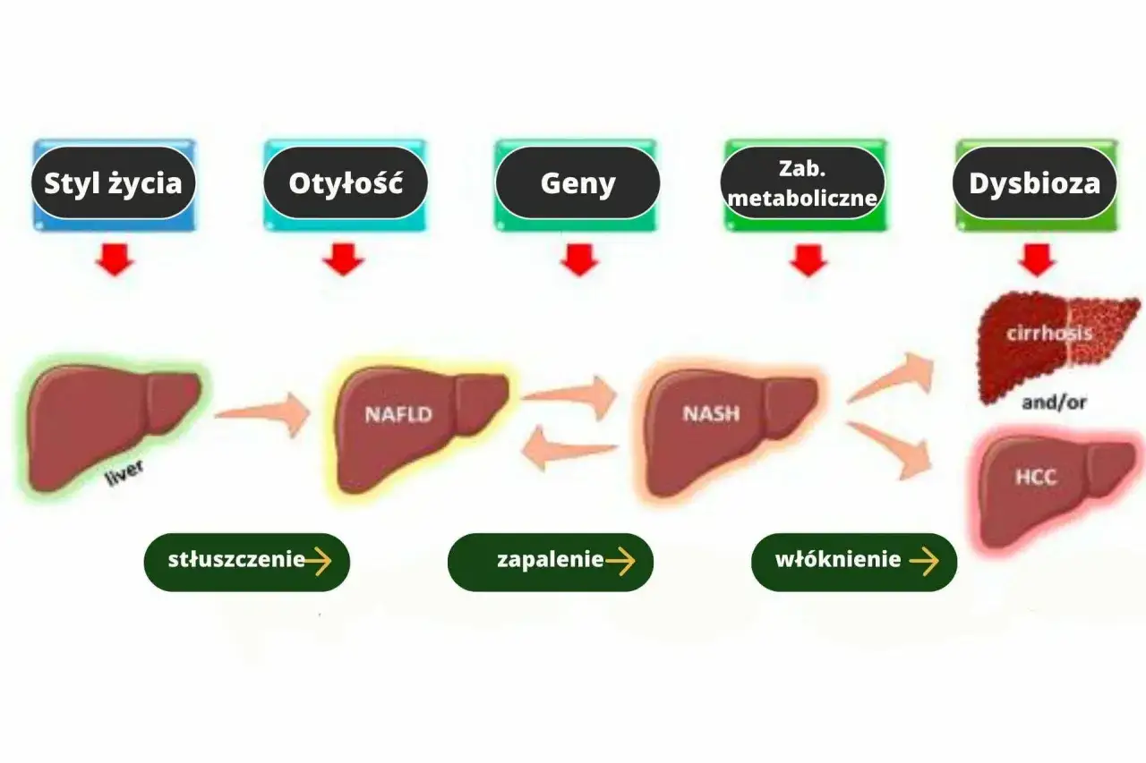 Rodzaje stłuszczenia wątroby