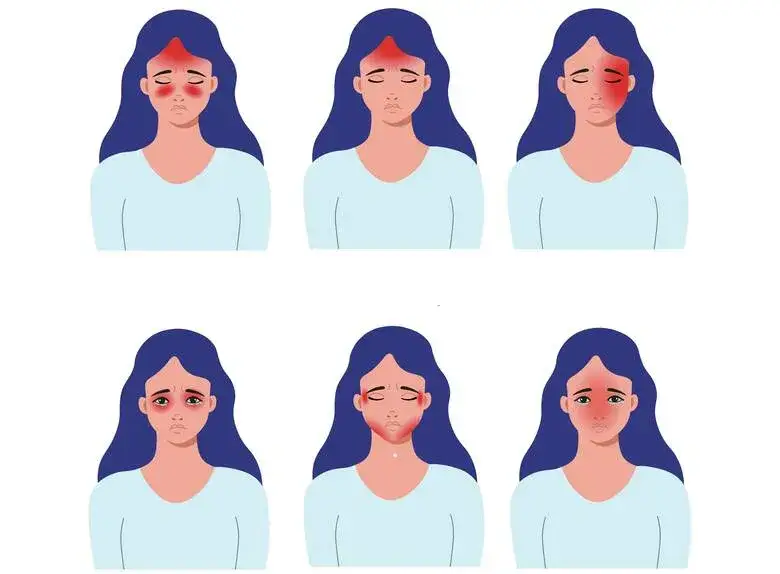 ból głowy przyczyny kręgosłup zatoki zęby