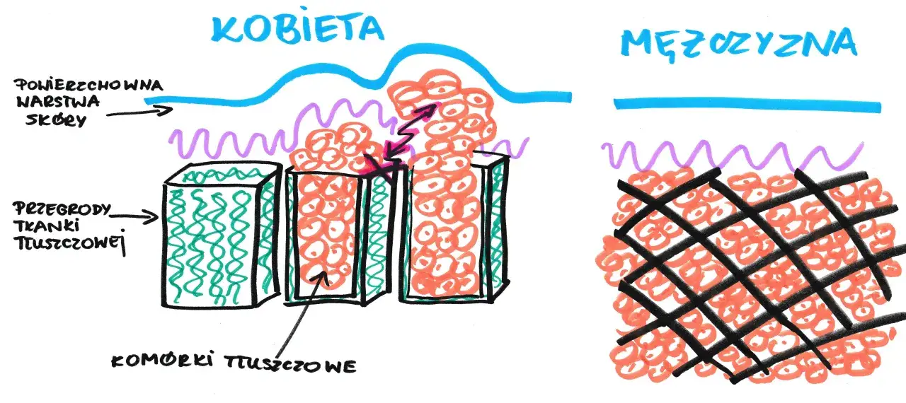 schemat powstawania cellulitu