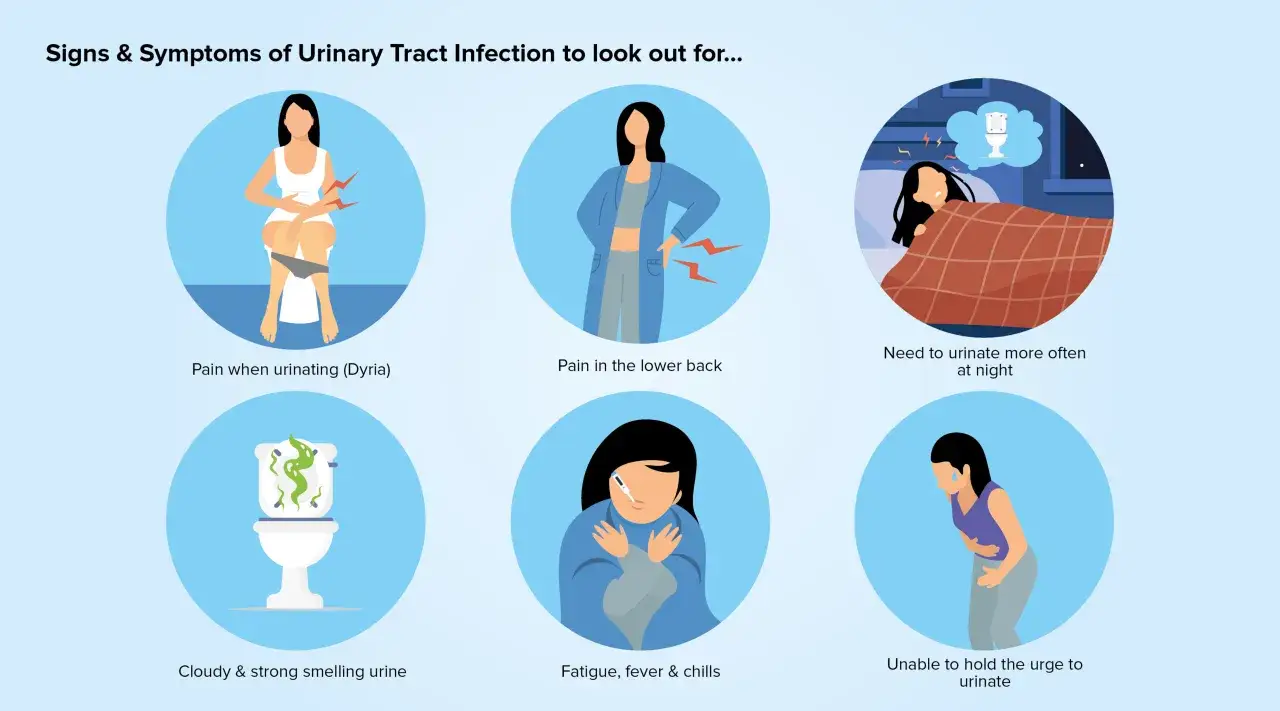 Objawy infekcji dr&oacute;g moczowych: b&oacute;l przy oddawaniu moczu, b&oacute;l w dole plec&oacute;w, częste oddawanie moczu w nocy, mętny mocz z bakteriami, zmęczenie, gorączka, dreszcze, nagła potrzeba oddania moczu.