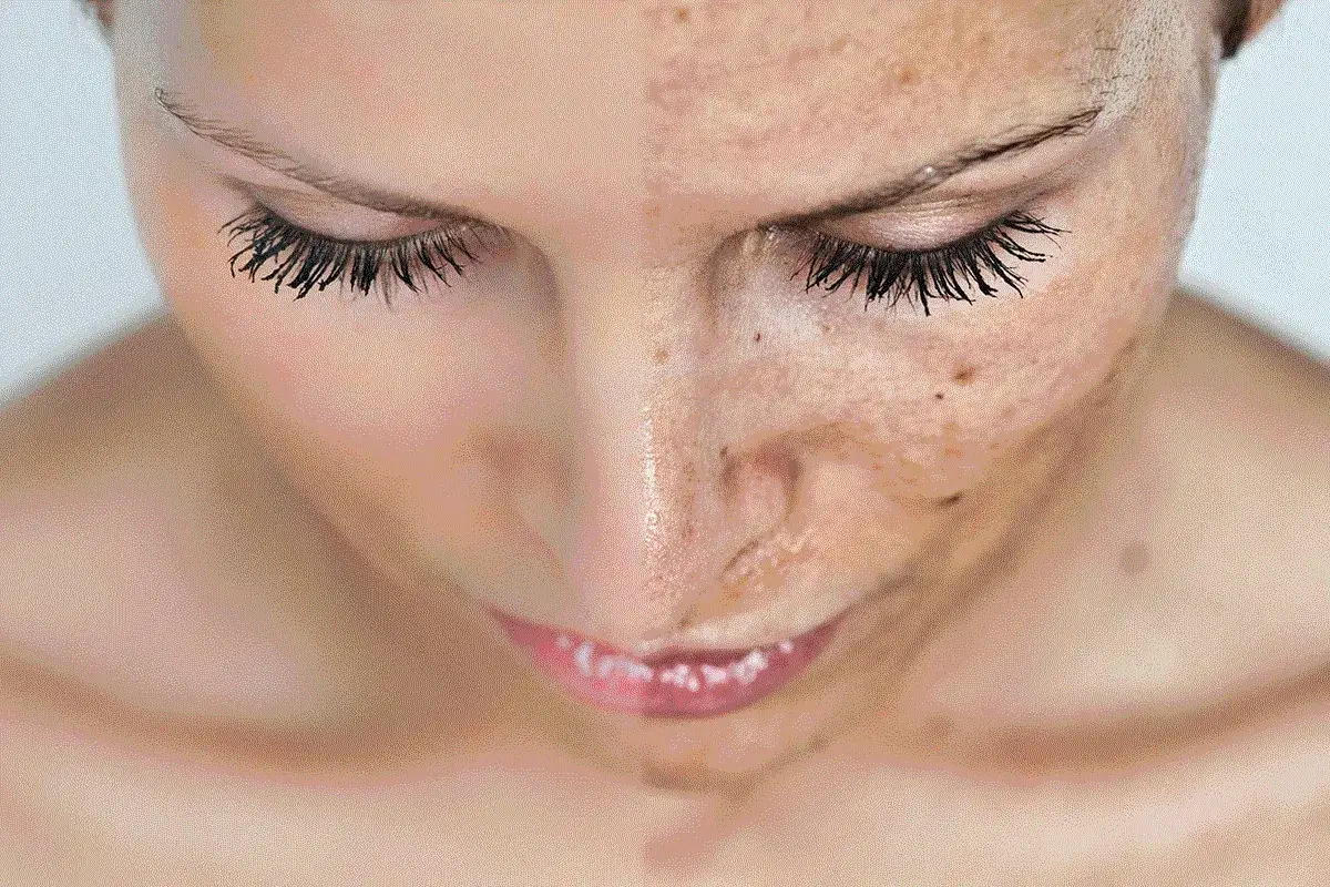 zabiegi na przebarwienia w gabinecie kosmetycznym