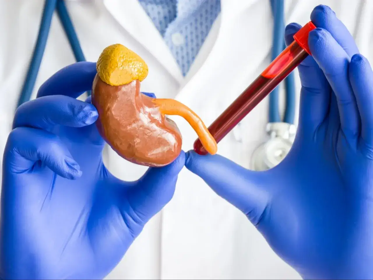 Lekarz w niebieskich rękawiczkach trzyma model nerki i prob&oacute;wkę z krwią. Badanie kreatyniny ocenia pracę nerek.